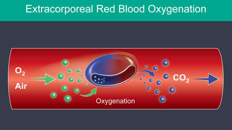 Extracorporeal Blood Oxygenation Ozonization East Freehold NJ