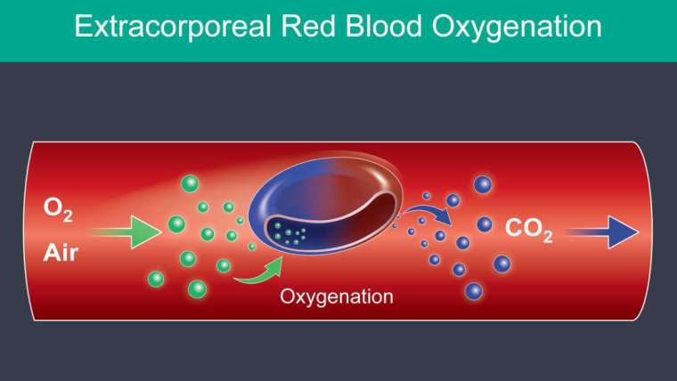 Extracorporeal Blood Oxygenation Ozonization Freehold NJ
